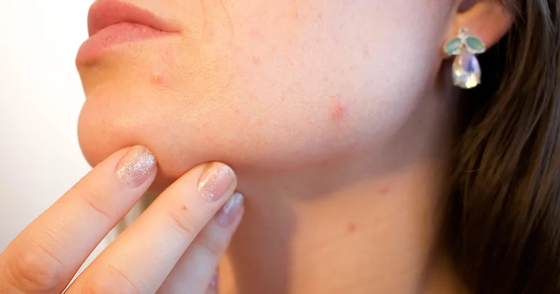 Pflanzliche Hormone, Gewichtszunahme und der Irrtum mit den Kalorien